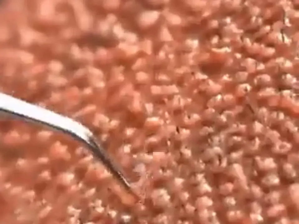 Innesti selezionati e contati al microscopio