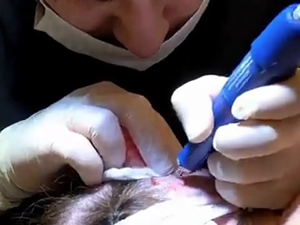 Innesti posati tra i capelli lunghi di una donna