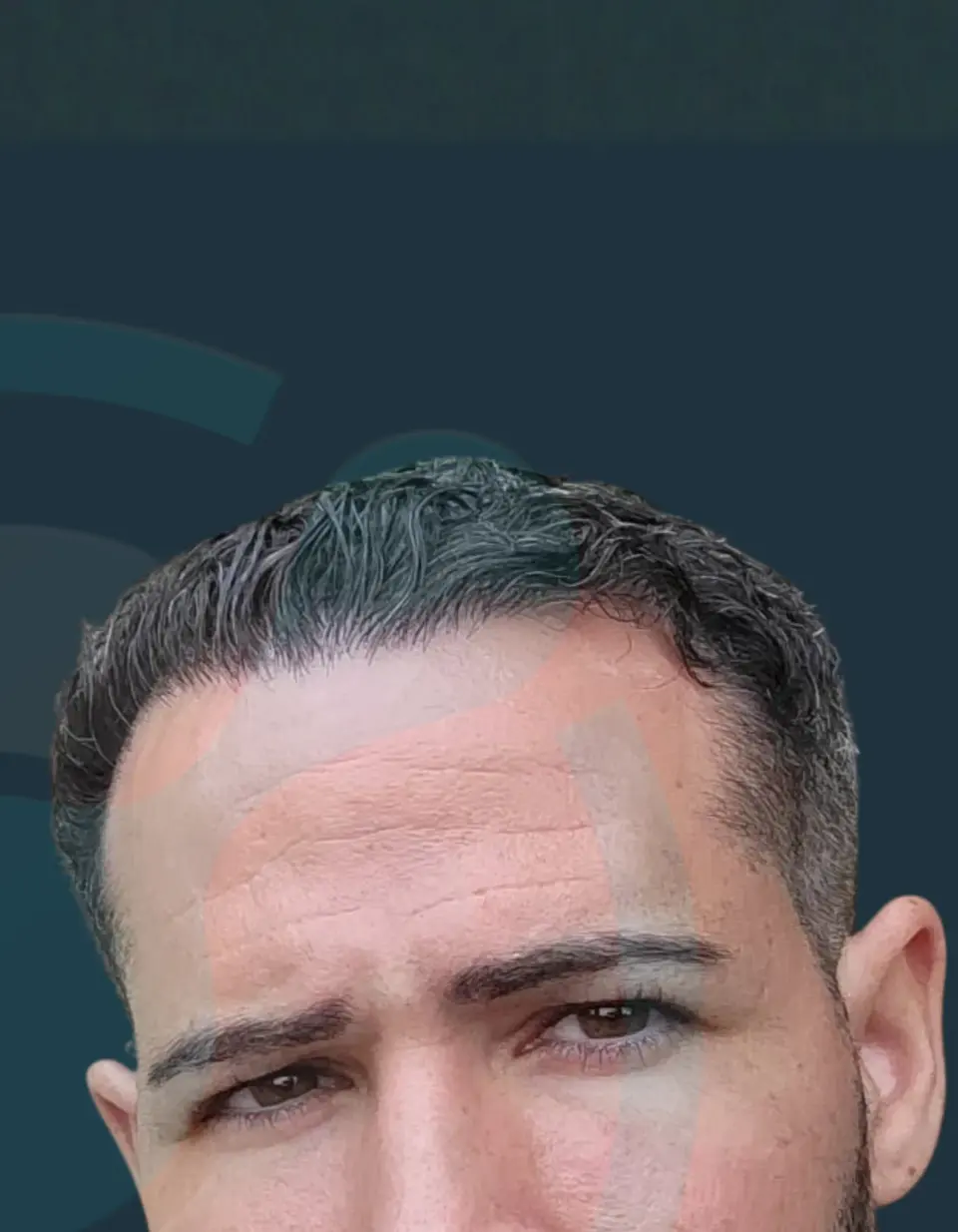 Riparim dhe rishikim
